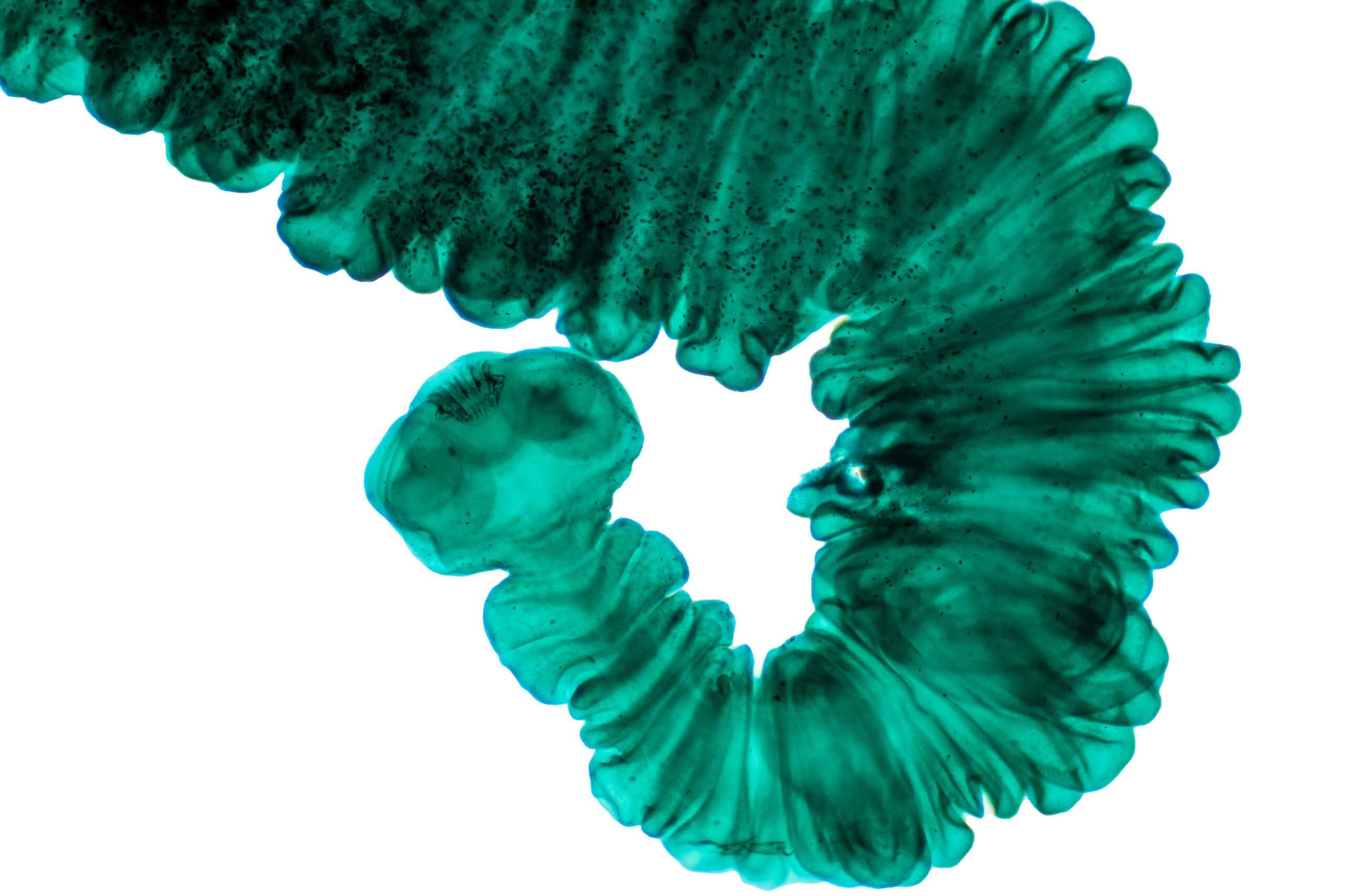 Fasciola hepatica, or liver fluke (low res)