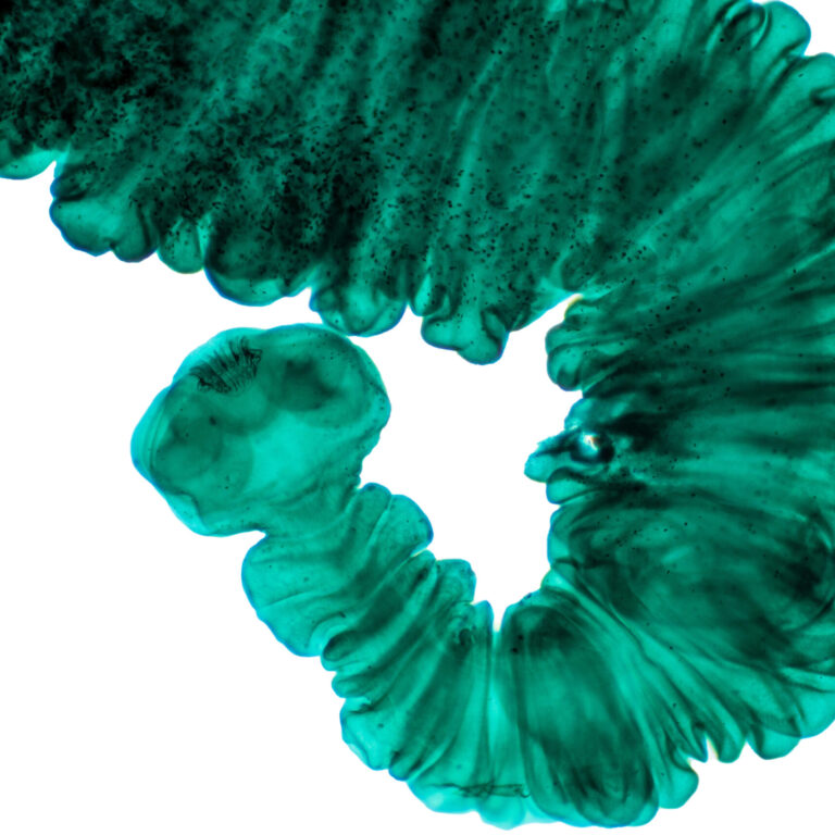 Fasciola hepatica, or liver fluke (low res)