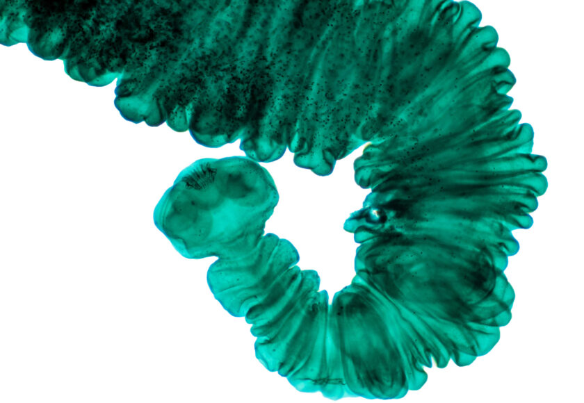Fasciola hepatica, or liver fluke (low res)